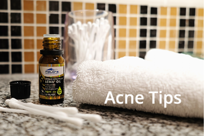 5 Bước Đơn Giản Đánh Bay Mụn Tràn Đầy Hiệu Quả